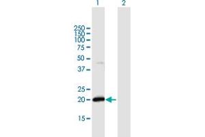 Western Blot analysis of IFNA21 expression in transfected 293T cell line by IFNA21 MaxPab polyclonal antibody.