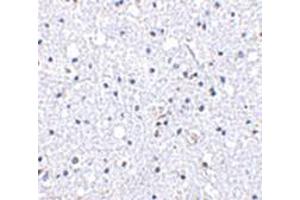 Immunohistochemistry of DARC in human brain tissue with DARC antibody at 5 μg/ml. (DARC antibody  (N-Term))