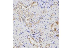 Immunohistochemistry (IHC) image for anti-ATG16 Autophagy Related 16-Like 1 (ATG16L1) antibody (ABIN1871137)
