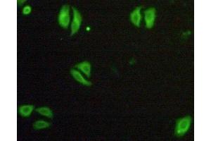 Detection of TNFR1 in Hela cells using Polyclonal Antibody to Tumor Necrosis Factor Receptor 1 (TNFR1) (TNFRSF1A antibody  (AA 248-428))