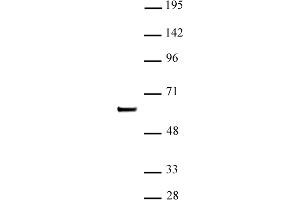 SETD7 / SET7 (pAb) tested by Western blot. (SETD7 antibody)