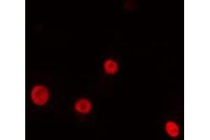 ABIN6275195 staining HeLa cells by IF/ICC. (NK2 Homeobox 4 antibody  (Internal Region))