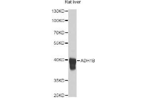 Western blot analysis of extracts of rat liver, using ADH1B antibody (ABIN1870818) at 1:1000 dilution.