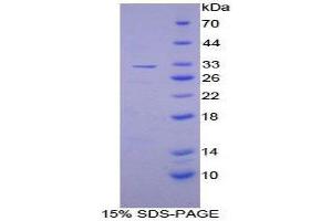 SDS-PAGE (SDS) image for Plasminogen Activator Inhibitor 2 (SERPINB2) (AA 68-313) protein (His tag) (ABIN1879307)