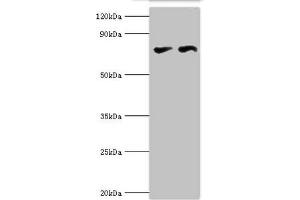 Western blot All lanes: Transcriptional repressor CTCF antibody at 6 μg/mL Lane 1: PC-3 whole cell lysate Lane 2: MCF-7 whole cell lysate Secondary Goat polyclonal to rabbit IgG at 1/10000 dilution Predicted band size: 83, 46 kDa Observed band size: 83 kDa (CTCF antibody  (AA 1-260))