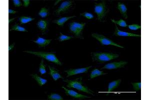 Immunofluorescence of purified MaxPab antibody to CYC1 on HeLa cell. (Cytochrome C1 antibody  (AA 1-325))