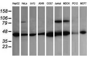 Western Blotting (WB) image for anti-Acetyl-CoA Acyltransferase 2 (ACAA2) antibody (ABIN2715630) (ACAA2 antibody)