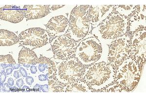 Immunohistochemical analysis of paraffin-embedded mouse testis tissue. (SMAD4 antibody  (AA 40-120))