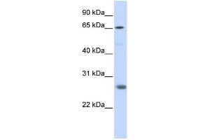 WB Suggested Anti-RNF186 Antibody Titration:  0. (RNF186 antibody  (N-Term))