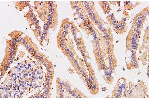 Immunohistochemistry of paraffin-embedded Human duodenum using Chromogranin A Polyclonal Antibody at dilution of 1:200 (Chromogranin A antibody)