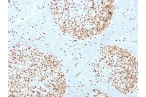Immunohistochemistry (IHC) image for anti-Topoisomerase (DNA) II alpha 170kDa (TOP2A) (AA 1352-1493) antibody (ABIN6940773)