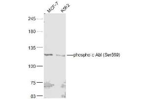 Western Blotting (WB) image for anti-C-Abl Oncogene 1, Non-Receptor tyrosine Kinase (ABL1) (pSer569) antibody (ABIN1715079)