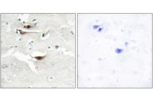 Immunohistochemistry (IHC) image for anti-Inositol 1,3,4,5,6-Pentakisphosphate 2-Kinase (IPPK) (AA 11-60) antibody (ABIN2889764) (IPPK antibody  (AA 11-60))