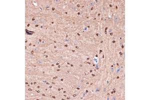 Immunohistochemistry of paraffin-embedded mouse brain using Carbonic Anhydrase 2 (C) Rabbit mAb (ABIN7266070) at dilution of 1:100 (40x lens). (CA2 antibody)
