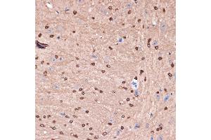 Immunohistochemistry of paraffin-embedded mouse brain using Carbonic Anhydrase 2 (C) Rabbit mAb (ABIN7266070) at dilution of 1:100 (40x lens). (CA2 antibody)