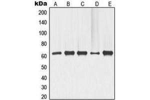 Western blot analysis of p63 expression in COLO205 (A), ME180 (B), HeLa (C), LOVO (D), HT29 (E) whole cell lysates.