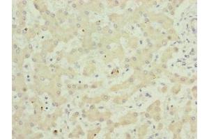 Immunohistochemistry of paraffin-embedded human liver tissue using ABIN7173949 at dilution of 1:100 (TWIST2 antibody  (AA 1-70))