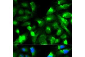 Immunofluorescence analysis of HeLa cells using SNAP25 Polyclonal Antibody (SNAP25 antibody)