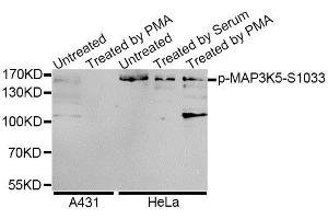 Western blot analysis of extracts of A-431 and HeLa cells, using Phospho-MAP3K5-S1033 antibody (ABIN5995640) at 1/1000 dilution. (ASK1 antibody  (pSer1033))