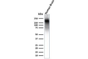 Western Blot Analysis of human brain lysate using Neurofilament Rabbit Recombinant Monoclonal Ab (NEFL. (Recombinant NEFH antibody)