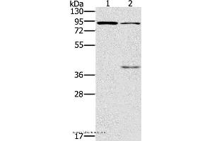 Western blot analysis of Mouse kidney and brain tissue, using CNGA3 Polyclonal Antibody at dilution of 1:500 (CNGA3 antibody)