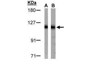 WB Image Sample(30 μg of whole cell lysate) A:HeLa S3 , B:Raji, 7. (DDB1 antibody)