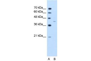 WB Suggested Anti-GNAS  Antibody Titration: 2.