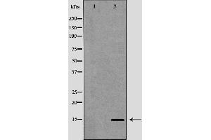 Western blot analysis of mouse heart using KCNE1 antibody. (KCNE1 antibody  (Internal Region))