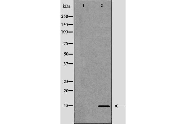 KCNE1 antibody  (Internal Region)