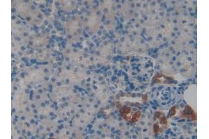 Used in DAB staining on fromalin fixed paraffin- embedded kidney tissue (CSTA antibody  (AA 1-103))