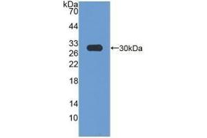 Detection of Recombinant HMGCR, Rat using Polyclonal Antibody to 3-Hydroxy-3-Methylglutaryl Coenzyme A Reductase (HMGCR) (HMGCR antibody  (AA 638-887))