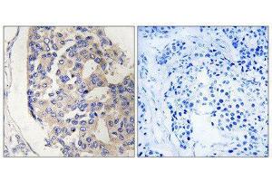 Immunohistochemistry (IHC) image for anti-Complement Component 1, S Subcomponent (C1S) (C-Term) antibody (ABIN1851152)