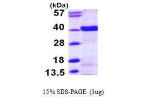 SDS-PAGE (SDS) image for N-Myc (And STAT) Interactor (NMI) (AA 1-307) protein (His tag) (ABIN667326)