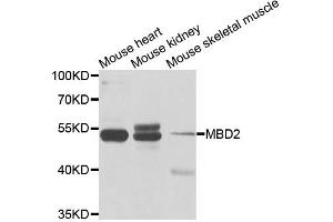 Western blot analysis of extracts of various cell lines, using MBD2 antibody (ABIN5971247) at 1/1000 dilution. (MBD2 antibody)