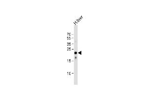 Anti-AB Antibody (Center)at 1:1000 dilution + human liver lysates Lysates/proteins at 20 μg per lane.