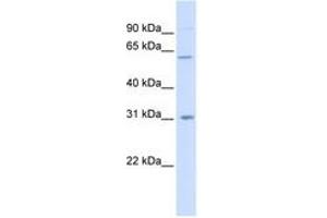 Image no. 1 for anti-Carbohydrate (N-Acetylglucosamine-6-O) Sulfotransferase 2 (CHST2) (C-Term) antibody (ABIN6740972)