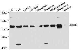 Western blot analysis of extracts of various cell lines, using MOGS antibody. (GCS1 antibody  (AA 60-320))