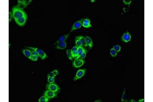 Immunofluorescent analysis of HepG2 cells using ABIN7146837 at dilution of 1:100 and Alexa Fluor 488-congugated AffiniPure Goat Anti-Rabbit IgG(H+L) (CPT1B antibody  (AA 165-318))