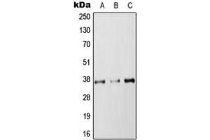Western blot analysis of RAB36 expression in HEK293T (A), NIH3T3 (B), PC12 (C) whole cell lysates.