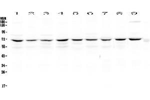 Western blot analysis of cIAP1 using anti-cIAP1 antibody . (BIRC2 antibody  (AA 320-570))