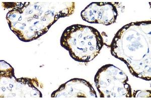 Immunohistochemistry of paraffin-embedded Human placenta using FGFR2 Polyclonal Antibody at dilution of 1:100 (40x lens). (FGFR2 antibody)