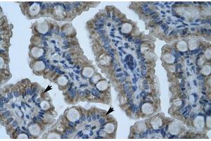 Human Intestine (ZNF461 antibody  (N-Term))