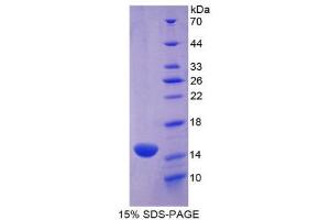 SDS-PAGE (SDS) image for Myeloperoxidase (MPO) (AA 139-252) protein (His tag) (ABIN1080348) (Myeloperoxidase Protein (MPO) (AA 139-252) (His tag))