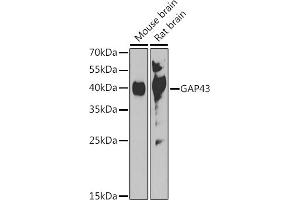 Western blot analysis of extracts of various cell lines, using G antibody (ABIN7267516) at 1:1000 dilution. (GAP43 antibody  (AA 1-238))