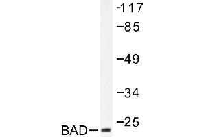 Image no. 1 for anti-BCL2-Associated Agonist of Cell Death (BAD) antibody (ABIN271900) (BAD antibody)