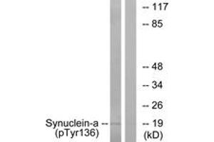 Western blot analysis of extracts from mouse brain, using Synuclein-alpha (Phospho-Tyr136) Antibody.