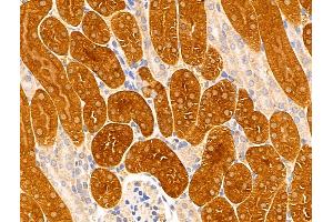 ABIN6261991 and ABIN6269006 at 1/100 staining Mouse kidney tissue by IHC-P. (GRIK2 antibody  (C-Term))