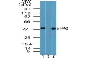 Image no. 2 for anti-Eukaryotic Translation Initiation Factor 4A2 (EIF4A2) (AA 1-50) antibody (ABIN960157) (EIF4A2 antibody  (AA 1-50))