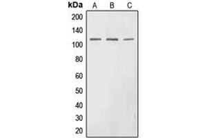 Western blot analysis of EPHA3 (pY602) expression in HEK293T (A), SP2/0 (B), H9C2 (C) whole cell lysates. (EPH Receptor A3 antibody  (pTyr602))