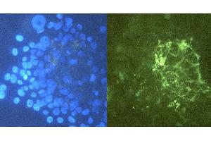 Immunocytochemistry staining of tenascin C in U-87 MG cells using purified mouse monoclonal antibody T2H7 (concentration in sample 12 μg/mL, GAM FITC, right picture) vs. (TNC antibody)